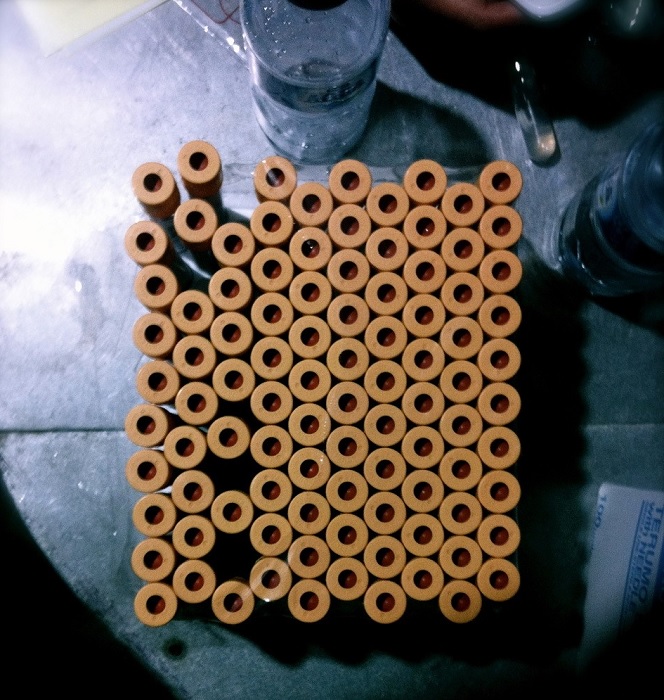 Tes darah di klinik VET / Ben Hegarty